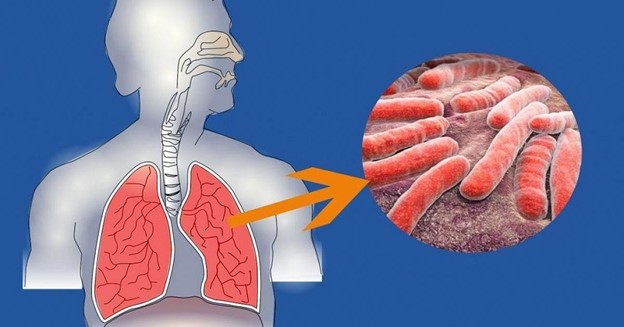 Туберкулездің пайда болу себептері /                              Причины появления туберкулеза