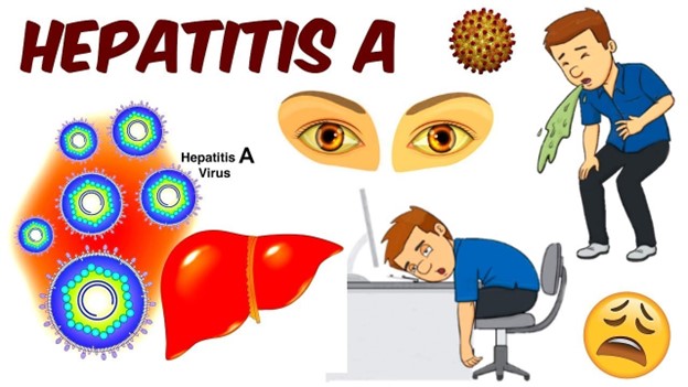А вирустық гепатиті / Вирусный гепатит А
